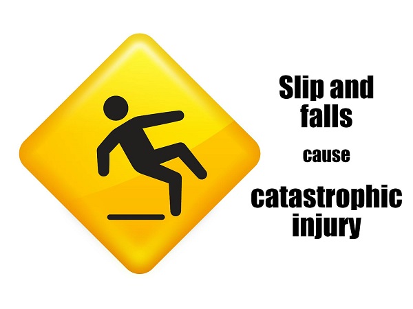 Slip and fall injury in South Bay